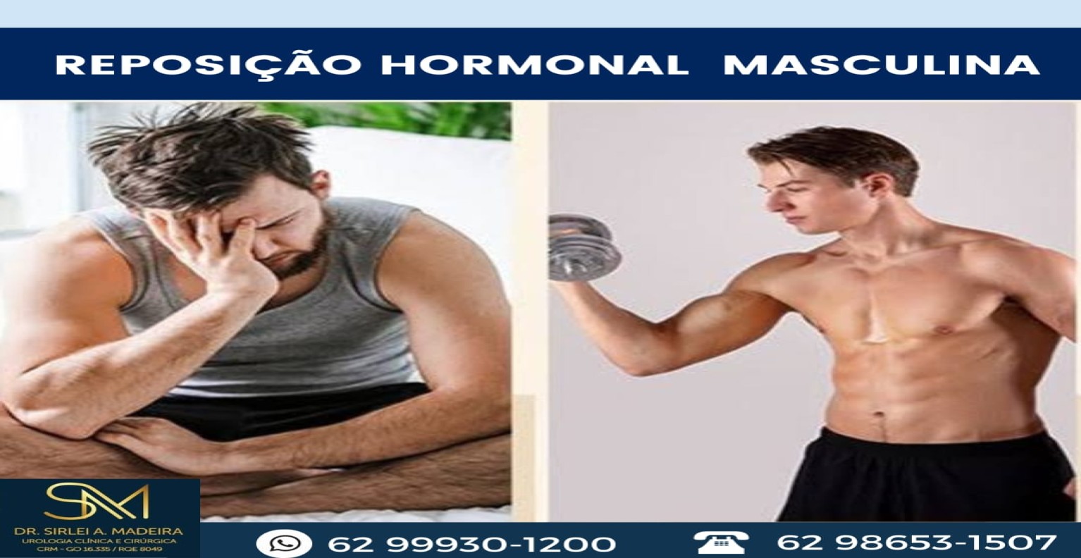 REPOSIÇÃO HORMONAL