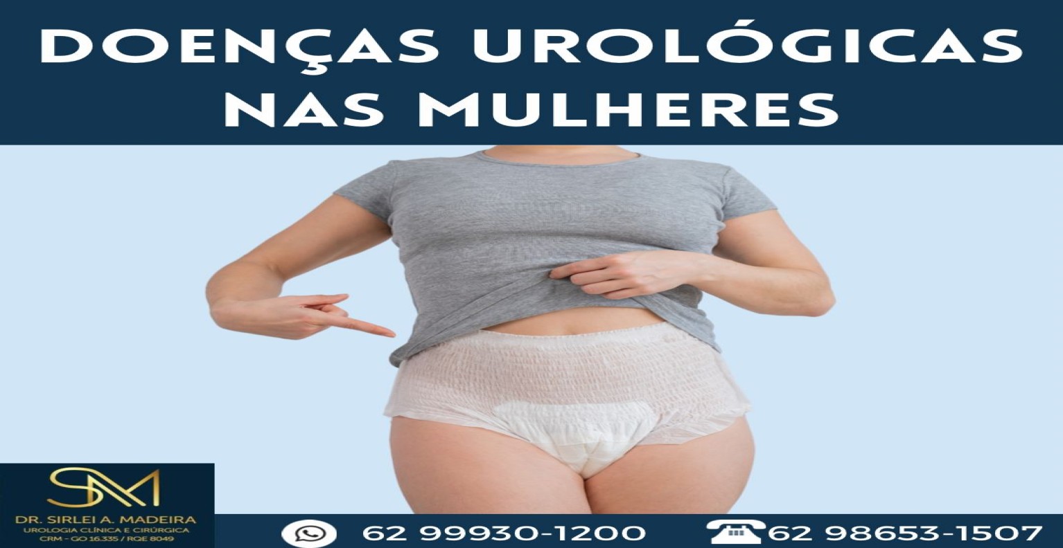 DOENÇAS UROLÓGICAS EM MULHERES